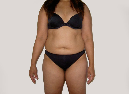 before-after-x